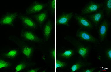 Anti-FOXO3A antibody [C3], C-term used in Immunocytochemistry/ Immunofluorescence (ICC/IF). GTX100277