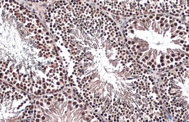 Anti-FOXO3A antibody [C3], C-term used in IHC (Paraffin sections) (IHC-P). GTX100277
