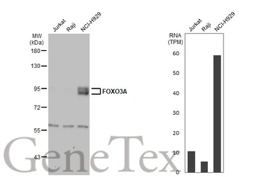 Anti-FOXO3A antibody [C3], C-term used in Western Blot (WB). GTX100277