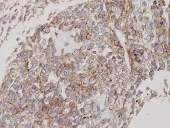 Anti-Flotillin 2 antibody [C3], C-term used in IHC (Paraffin sections) (IHC-P). GTX100279