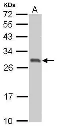 Anti-14-3-3 sigma antibody used in Western Blot (WB). GTX100289
