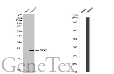 Anti-GPX2 antibody [C1C3] used in Western Blot (WB). GTX100292