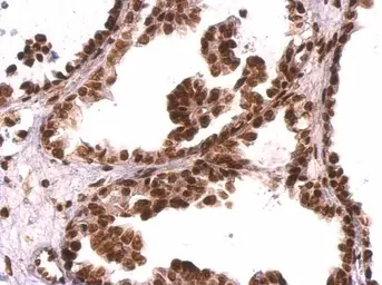 Anti-GRB2 antibody used in IHC (Paraffin sections) (IHC-P). GTX100294