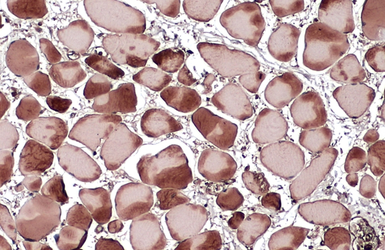 Anti-beta Actin antibody used in IHC (Paraffin sections) (IHC-P). GTX100313