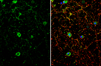 Anti-Dopamine Receptor D1 antibody [C2C3], C-term used in Immunocytochemistry/ Immunofluorescence (ICC/IF). GTX100354