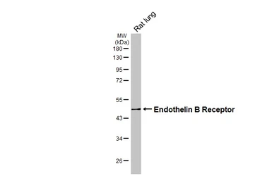 Anti-Endothelin B Receptor antibody used in Western Blot (WB). GTX100357