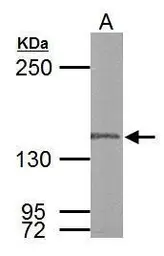 Anti-DNA polymerase gamma antibody used in Western Blot (WB). GTX100398