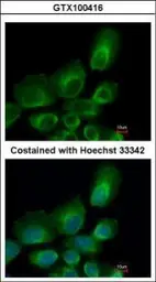 Anti-UBE2B antibody used in Immunocytochemistry/ Immunofluorescence (ICC/IF). GTX100416