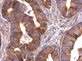 Anti-Survivin antibody used in IHC (Paraffin sections) (IHC-P). GTX100441
