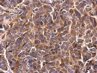 Anti-Survivin antibody used in IHC (Paraffin sections) (IHC-P). GTX100441