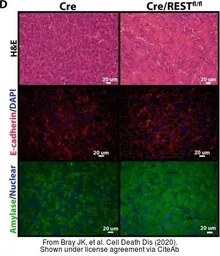 Anti-E-Cadherin antibody used in IHC (Paraffin sections) (IHC-P). GTX100443