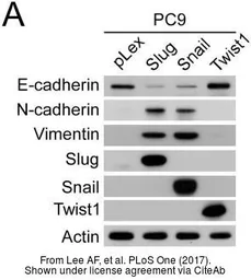 Anti-E-Cadherin antibody used in Western Blot (WB). GTX100443