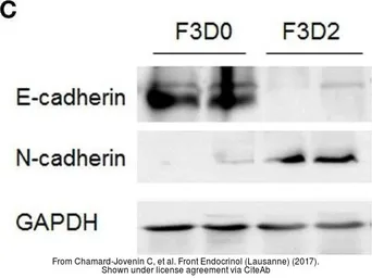 Anti-E-Cadherin antibody used in Western Blot (WB). GTX100443