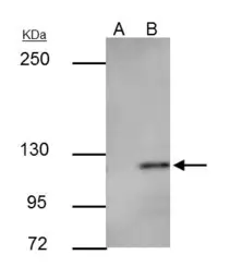 Anti-E-Cadherin antibody used in Immunoprecipitation (IP). GTX100443