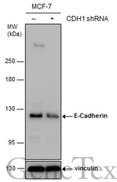 Anti-E-Cadherin antibody used in Western Blot (WB). GTX100443