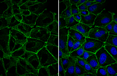 Anti-E-Cadherin antibody used in Immunocytochemistry/ Immunofluorescence (ICC/IF). GTX100443