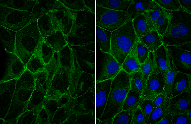 Anti-E-Cadherin antibody used in Immunocytochemistry/ Immunofluorescence (ICC/IF). GTX100443