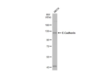 Anti-E-Cadherin antibody used in Western Blot (WB). GTX100443