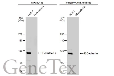 Anti-E-Cadherin antibody used in Western Blot (WB). GTX100443