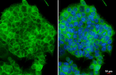 Anti-E-Cadherin antibody used in Immunocytochemistry/ Immunofluorescence (ICC/IF). GTX100443