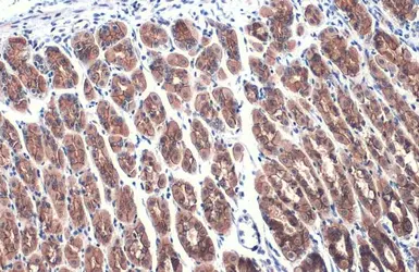 Anti-E-Cadherin antibody used in IHC (Paraffin sections) (IHC-P). GTX100443