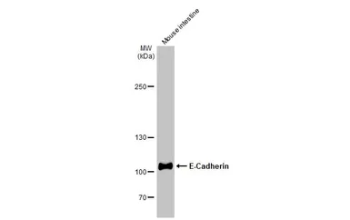 Anti-E-Cadherin antibody used in Western Blot (WB). GTX100443