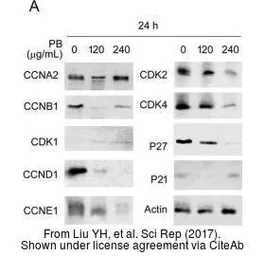Anti-p21 Cip1 antibody used in Western Blot (WB). GTX100444