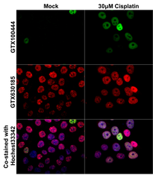 Anti-p21 Cip1 antibody used in Immunocytochemistry/ Immunofluorescence (ICC/IF). GTX100444