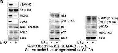 Anti-p27 Kip1 antibody used in Western Blot (WB). GTX100446
