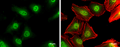 Anti-p27 Kip1 antibody used in Immunocytochemistry/ Immunofluorescence (ICC/IF). GTX100446