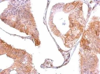 Anti-EGFR antibody [C2C3], C-term used in IHC (Paraffin sections) (IHC-P). GTX100448