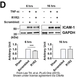 Anti-ICAM1 / CD54 antibody [N1C2] used in Western Blot (WB). GTX100450
