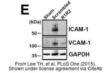 Anti-ICAM1 / CD54 antibody [N1C2] used in Western Blot (WB). GTX100450