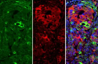 Anti-ICAM1 / CD54 antibody [N1C2] used in IHC (Paraffin sections) (IHC-P). GTX100450