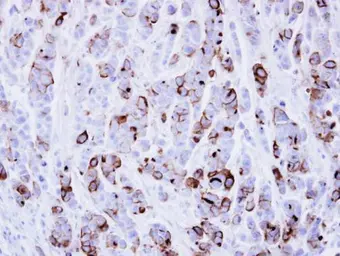 Anti-ICAM1 / CD54 antibody [N1C2] used in IHC (Paraffin sections) (IHC-P). GTX100450
