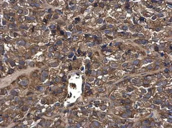 Anti-MUC1 antibody used in IHC (Paraffin sections) (IHC-P). GTX100459