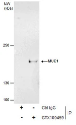Anti-MUC1 antibody used in Immunoprecipitation (IP). GTX100459