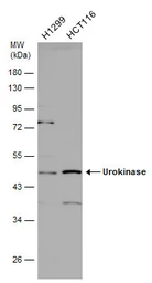 Anti-Urokinase antibody used in Western Blot (WB). GTX100465