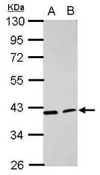Anti-ACADL antibody [N1N2], N-term used in Western Blot (WB). GTX100486