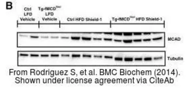 Anti-ACADM antibody used in Western Blot (WB). GTX100488