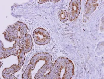 Anti-ACADM antibody used in IHC (Paraffin sections) (IHC-P). GTX100488