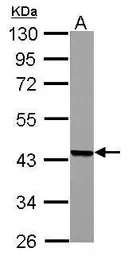 Anti-ACADM antibody used in Western Blot (WB). GTX100488