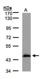 Anti-ACADM antibody used in Western Blot (WB). GTX100488