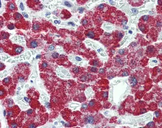 Anti-ACADS antibody used in IHC (Paraffin sections) (IHC-P). GTX100490