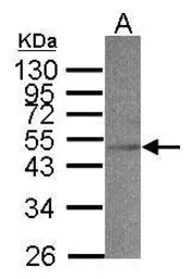 Anti-ACADS antibody used in Western Blot (WB). GTX100490