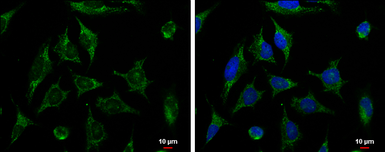 Anti-XIAP antibody [C1C3] used in Immunocytochemistry/ Immunofluorescence (ICC/IF). GTX100496