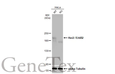 Anti-Her2 / ErbB2 antibody used in Western Blot (WB). GTX100509