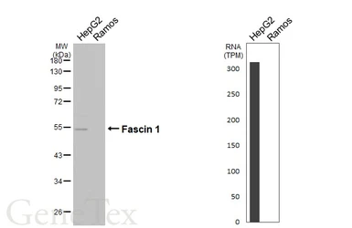 Anti-Fascin 1 antibody [N2C2], Internal used in Western Blot (WB). GTX100511