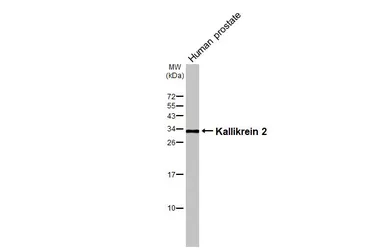 Anti-Kallikrein 2 antibody [N3C3] used in Western Blot (WB). GTX100526