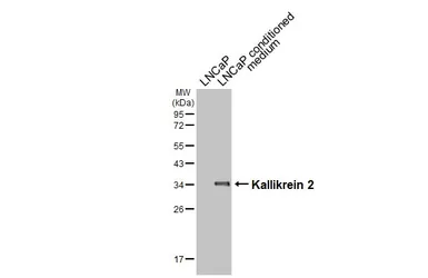 Anti-Kallikrein 2 antibody [N3C3] used in Western Blot (WB). GTX100526